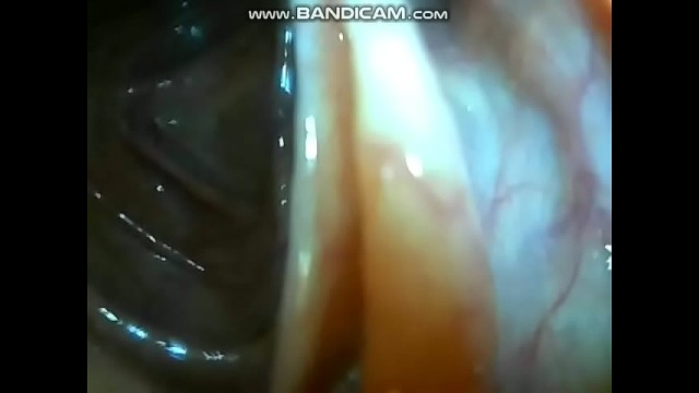 Pepper Amateur Games Fetish Medical Xxx Hot Sex Endoscope Porn